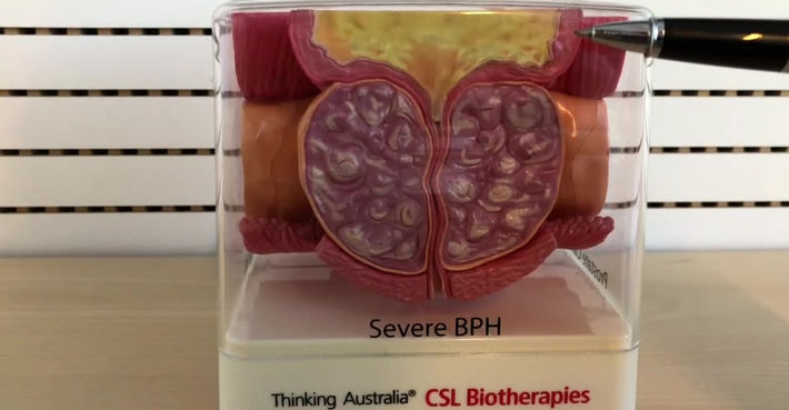 BHP2